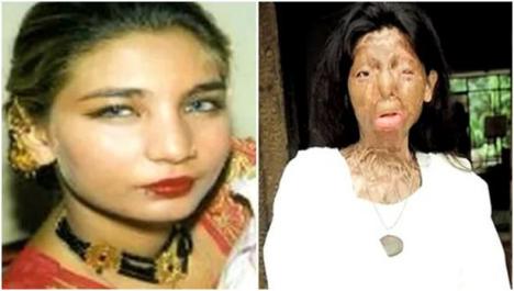 Fakhra Yunus Before and After acid attack by her ex husband Bilal Khar - 032912_0519_fakhrayunus1